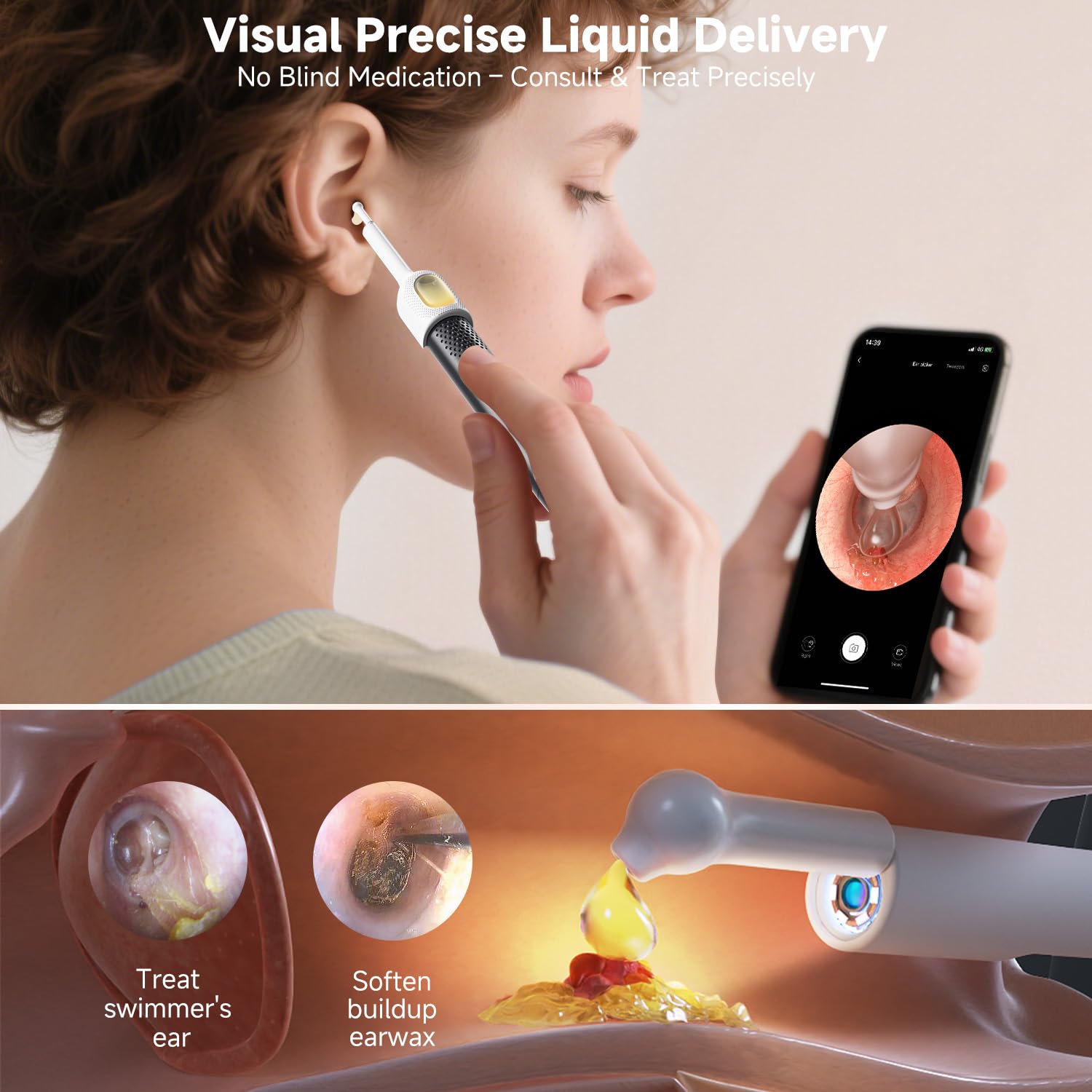 BEBIRD R1 Ultra Ear Wax Remova, Ear Cleaner with Camera Ear Scope, Wax Remove Ear Pick with Ear Otoscope Tweezers, Visual Dropper Cleaning Kit, Ear/Nose/Throat Examination Tool for Family, Black