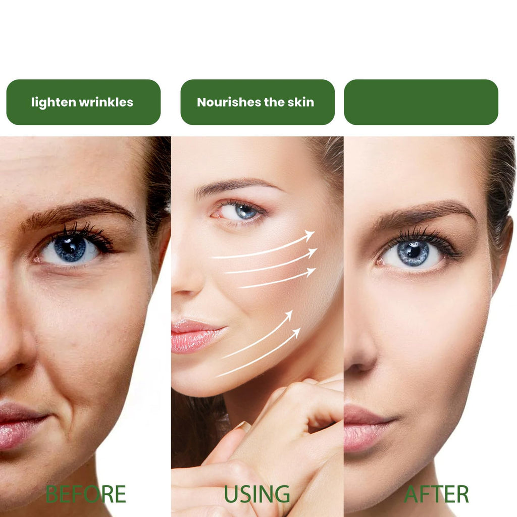 Silk Protein Thread Lifting Set,Silk Peptide Intensive Lifting Ampoule,Absorbable Collagen Thread for Face Lift, Smoothes Fine Lines