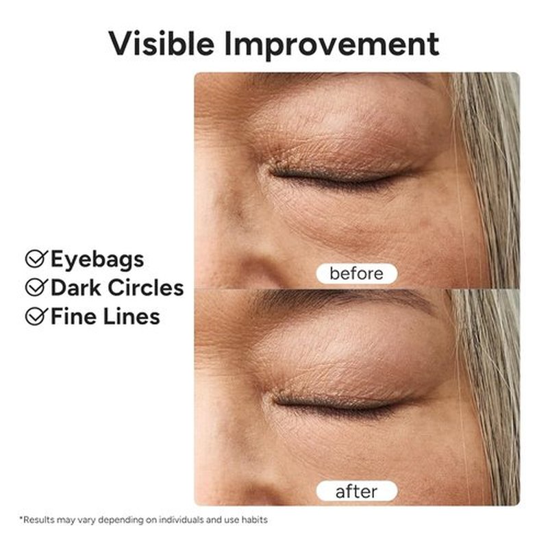 In My Eyes Eye Repair Gel Cream - Anti-Wrinkle Under Eye Treatment with Caffeine & Lutein, 0.5 oz.