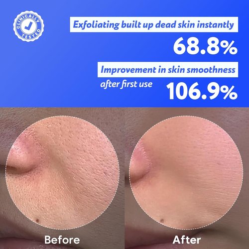 Skiennix Coconut Jelly Pudding Cleanser - Deep Pore Cleansing & Gentle Exfoliation | Hydrating Face Wash (100ml)