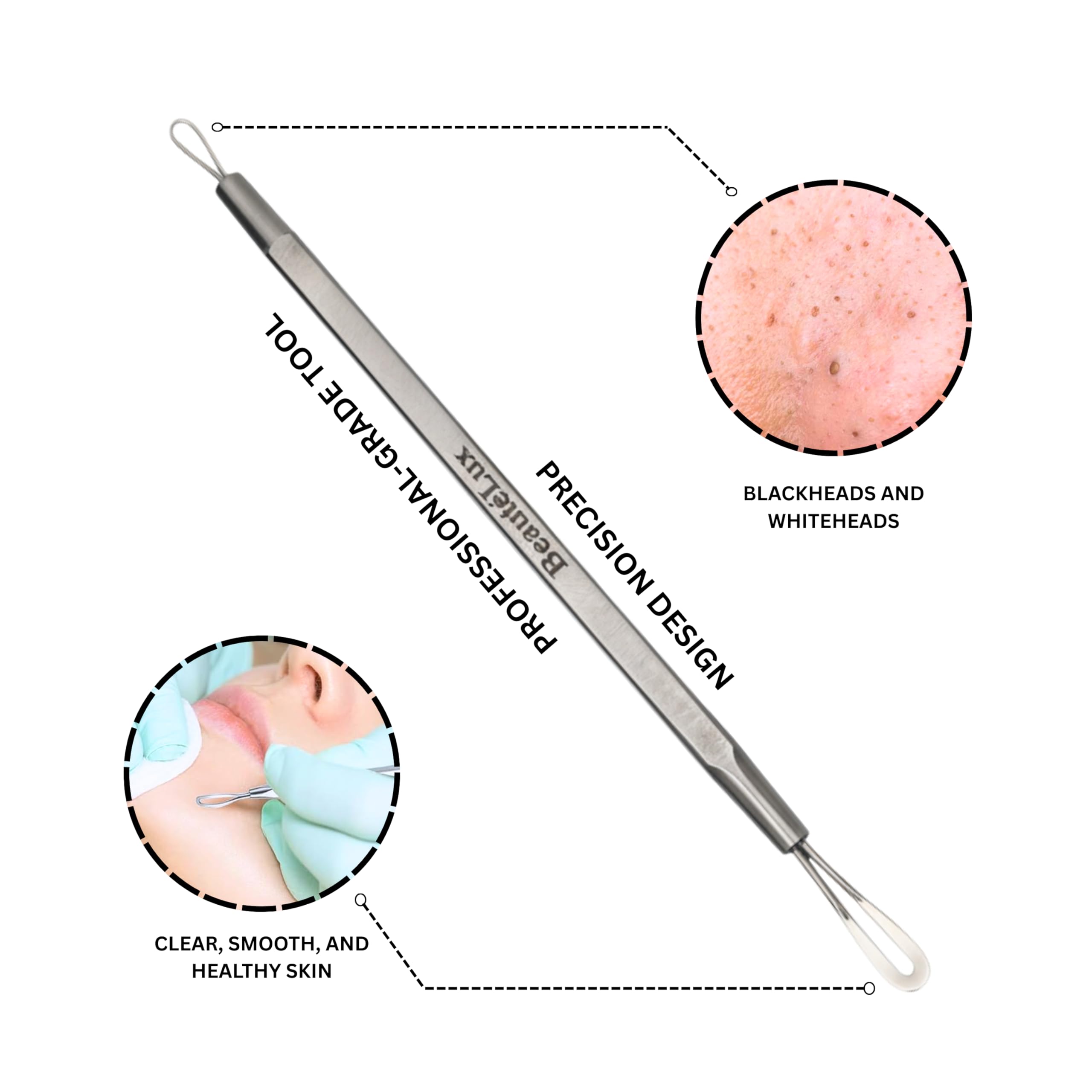 BeautéLux 2-in-1 Blackhead Removal Tool, Stainless Steel Acne Extractor, Blackhead & Whitehead Remover for Face/Nose, Dual-Loop Pimple Extractor, Skin Blemish Tool