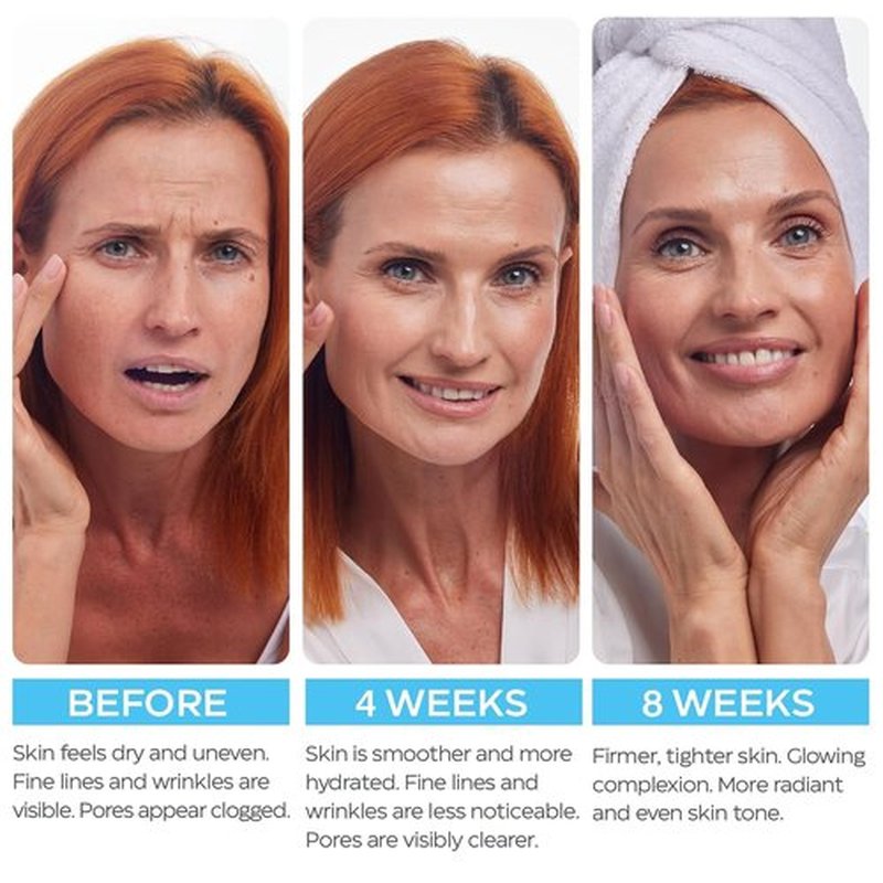 Retinol Cream for Face with Hyaluronic Acid, Day-Night Anti-Aging Moisturizer for Women, Men, Collagen Cream for Face Reduces Wrinkles, Dryness, 1.85 Oz