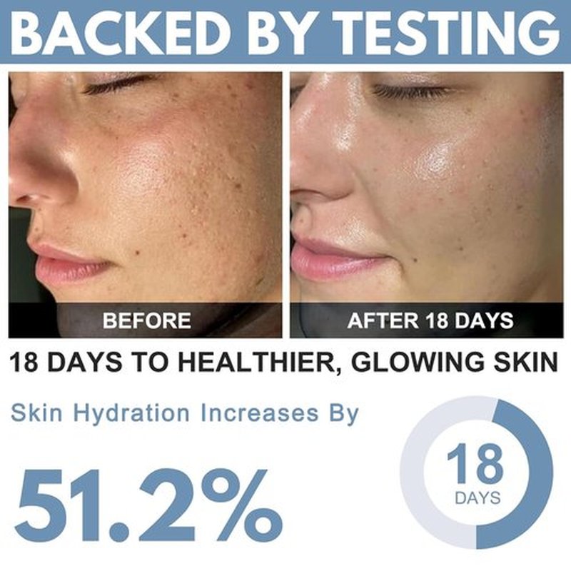 Ribose Cream - Anti-Aging Moisturizer with D-Ribose & Coconut Oil | Tightens & Firms Skin, 2.5 oz