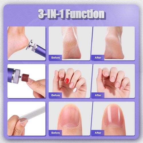 Electric Callus Remover for Feet, Cordless Foot File Pedicure Tool, Foot Sander Nail Grinder with 60+10PCS Sandpapers for Dead Skin Dry Calluses, 3 in 1 Foot Scrubber & Nail File (Purple)