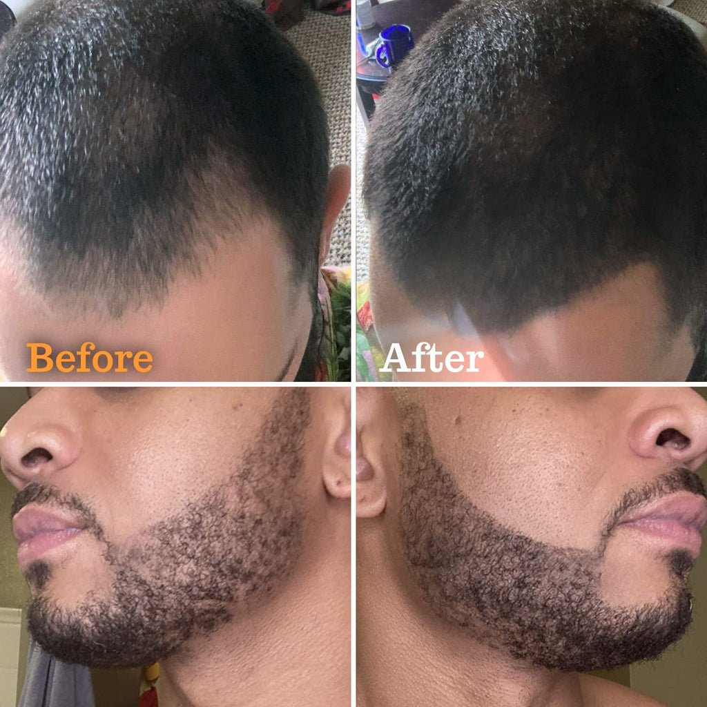 FOLLICLE BOOSTER Beard Pen Filler Styling Kit for Men - 3-in-1 Filling Set with 4-Tip Fork, Normal Pencil, and Brush - Waterproof, Sweatproof & All-Day Hold - Medium Black