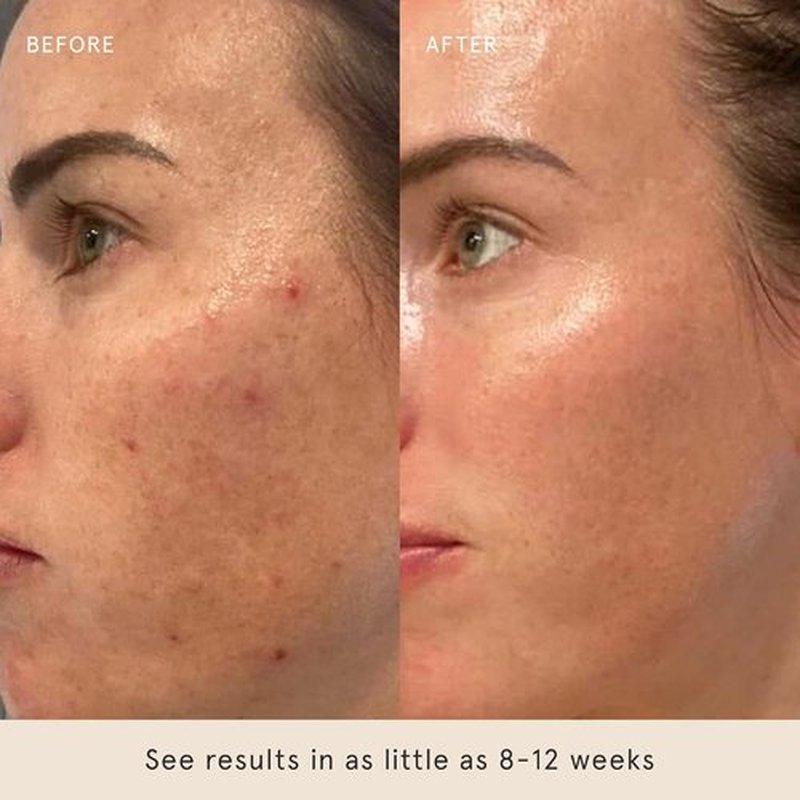 Barefaced Retinal Skin Therapy Serum - Firming Retinaldehyde & Bakuchiol, 30ml | Reduces Fine Lines & Improves Skin Tone