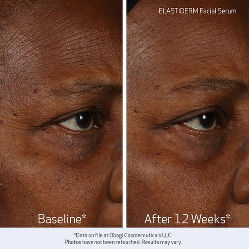 Obagi ELASTIDERM Facial Serum & Eye Serum Set - Firm Skin, Reduce Signs of Aging | 1oz & 0.47oz