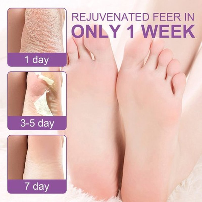 Foot Peel Masks for Dry Cracked Feet 5 Pack,Exfoliating Foot Mask, Natural Exfoliator for Dead Skin, Callus, Repair Rough Heels for Men Women,Make your Foot Baby Soft in 7 Days, AlIVER