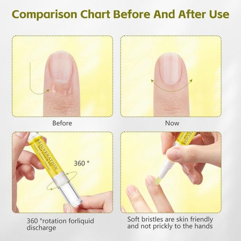 Rejuvenation Nail Growth Oil - Nail Strengthener and Growth Serum with Nail File (4PCS)