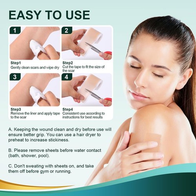 Medical Grade Silicone Scar Sheets, Silicone Scar Tape (1.6”x 60” Roll-1.5M), Professional Scar Removal Treatment, Reusable Silicone Scar Strip for Keloid, C-Section, Surgery, Burns, Acne Etc