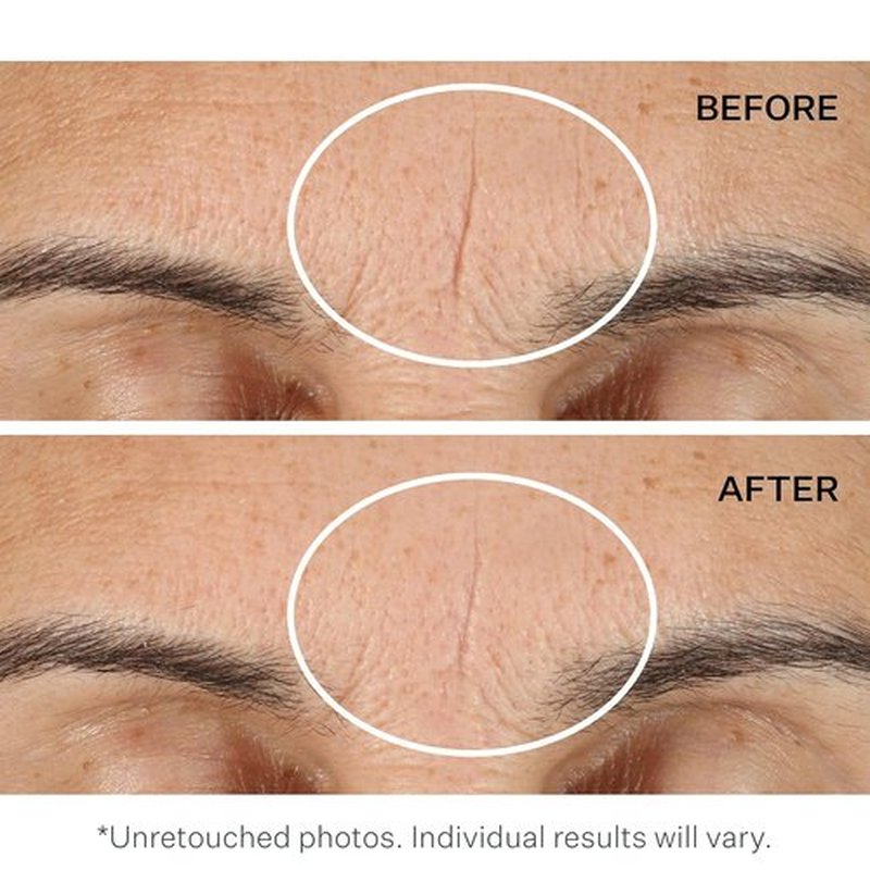 StriVectin Exfoliating Face Pads - Advanced Resurfacing & Line BlurFector™ Primer for Instant Wrinkle Reduction