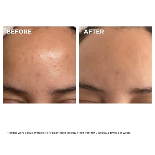 Clarins Beauty Flash Peel - 10-Minute At-Home Facial for Pore Tightening & Skin Renewal | All Skin Types