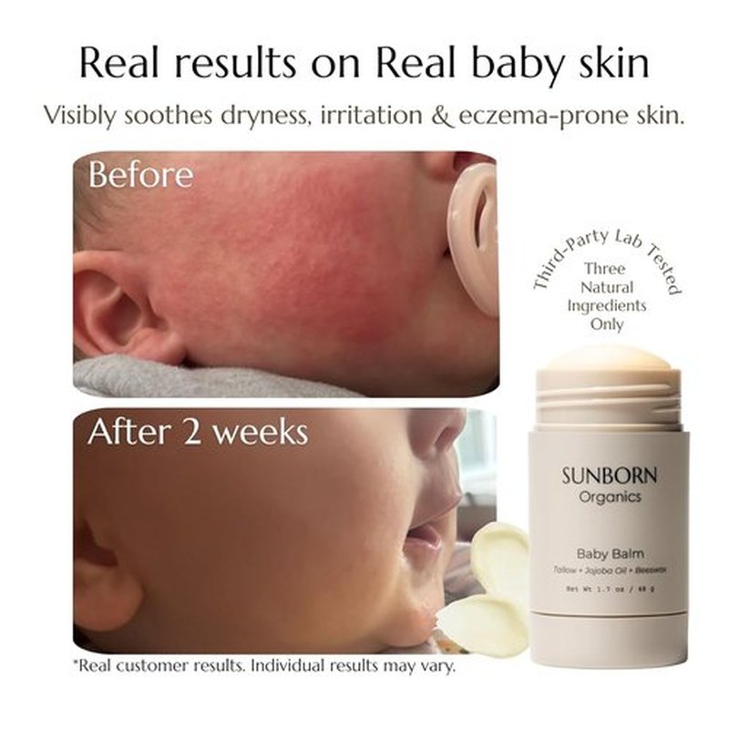 Baby Balm - Natural Moisturizing Stick for Eczema Relief & Diaper Rash | Grass-Fed Tallow, Organic Jojoba, Beeswax | Lab Tested & Baby-Safe, Made in USA