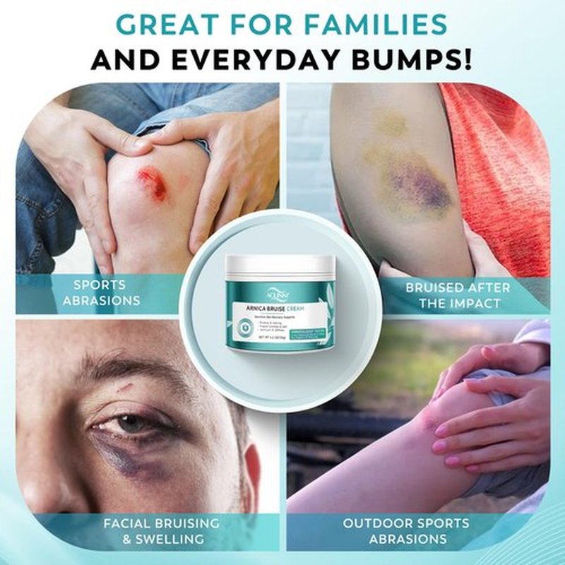 ACLINKI Arnica Bruise Cream for Bruising & Swelling Relief – Arnica Montana with Vitamins K, C & E – Lightweight Non-Greasy Cream for Sensitive & Thin Skin, Face & Body,Fragrance Free, 4.2 oz