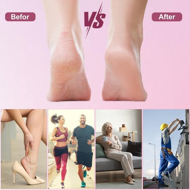 Electric Foot Callus Remover – Foot Callus Remover for Feet with 60 Sandpaper Discs, Adjustable Speed Pedicure Tools for Dead Skin, Professional Electric Feet Callus Remover for Home Use
