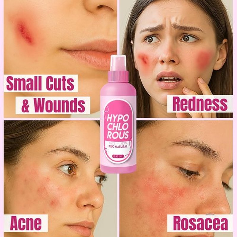 HOCl Hypochlorous Acid Spray Pure 250 ml / 8.4 oz – Natural Skin & Face Mist – Gentle Refreshing Formula for Cleansing, Soothing & Deodorizing – Alcohol-Free & pH Balanced