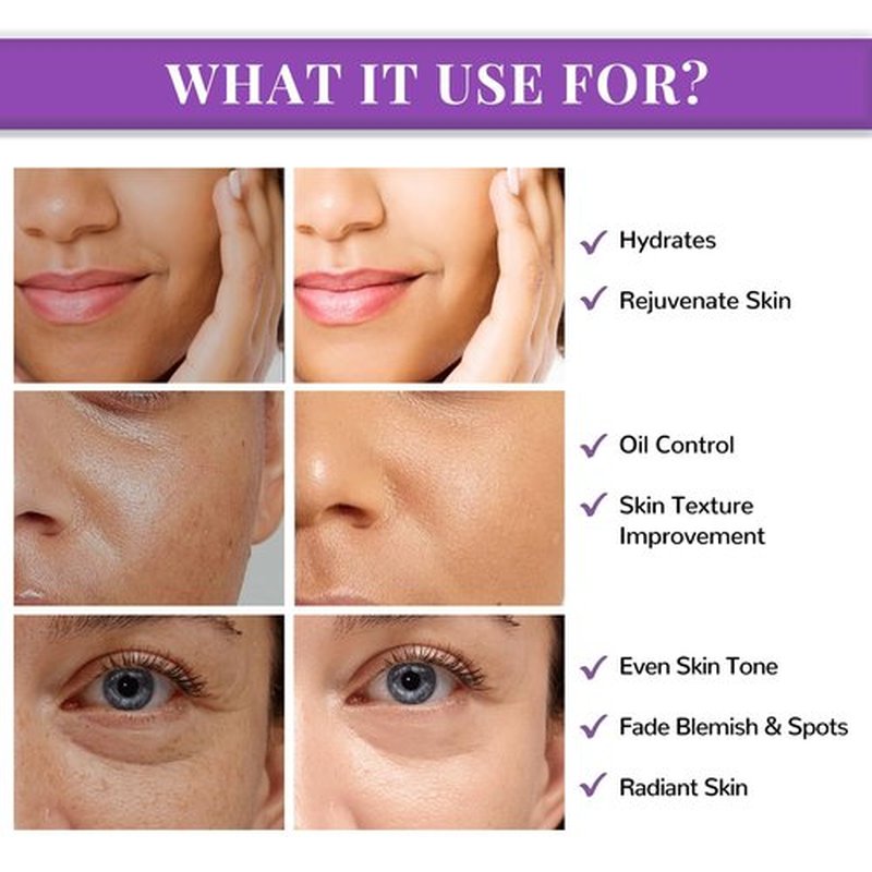 ANAI RUI Niacinamide Toner Pads,with Glutathione, Niacinamide, LHA, PHA, Facial Radiance Wipes for Even Skin Tone, Reduce Blemish and Spots 50 Pads