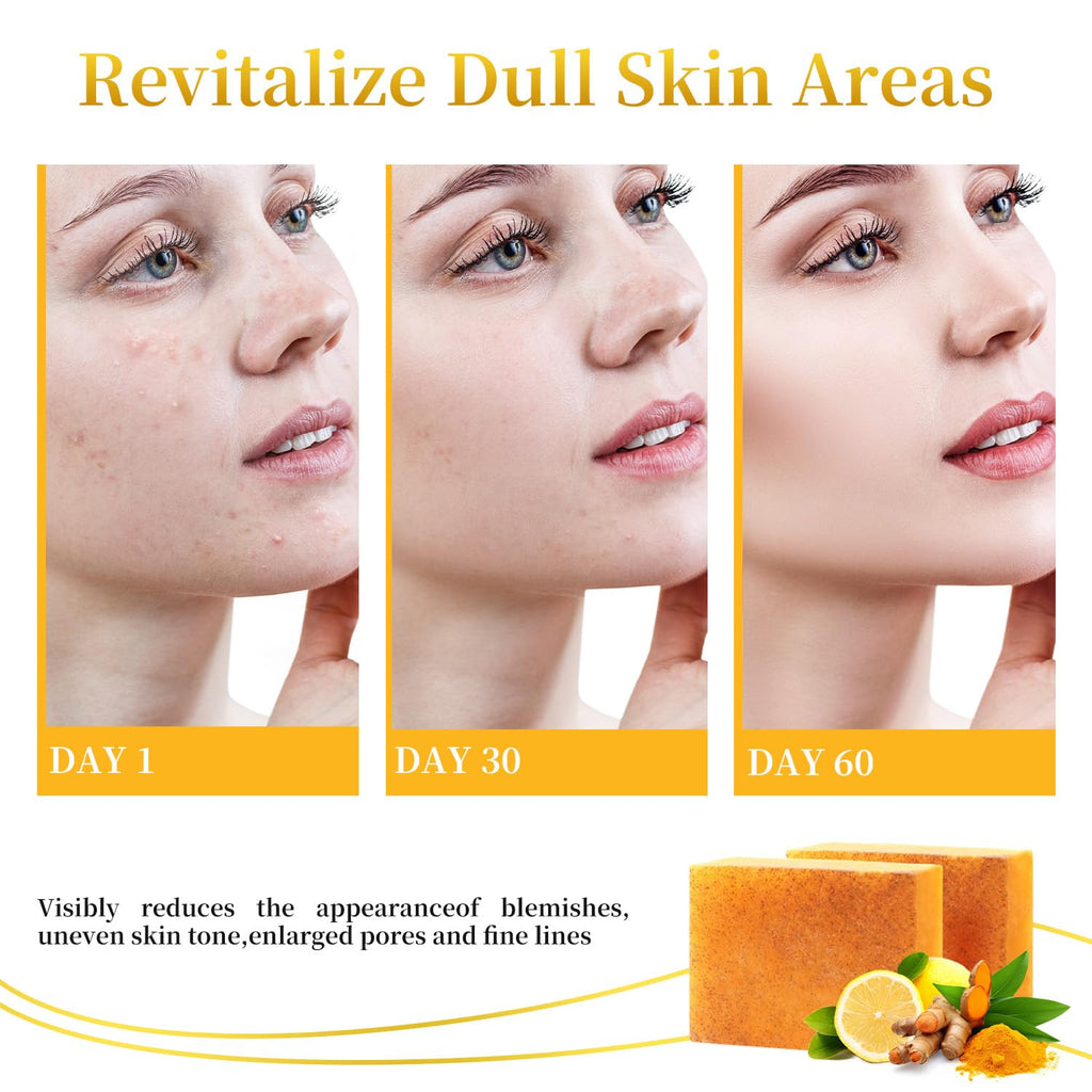 DOXOLATO Lemon Turmeric Soap Bars for Face Body - Gentle Exfoliating Turmeric Soap Bar Improve Skin Texture Moisturizing, 3 Bars