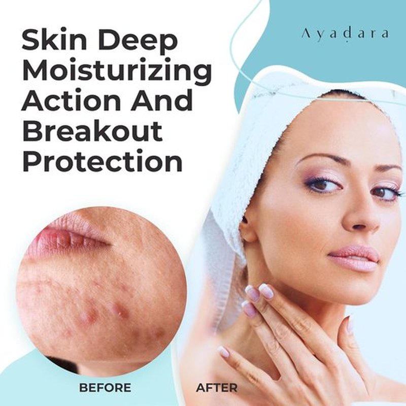 Ayadara Moisturizing Acne Cream - Salicylic Acid Face Moisturizer for Oily Skin | 90-Day Supply