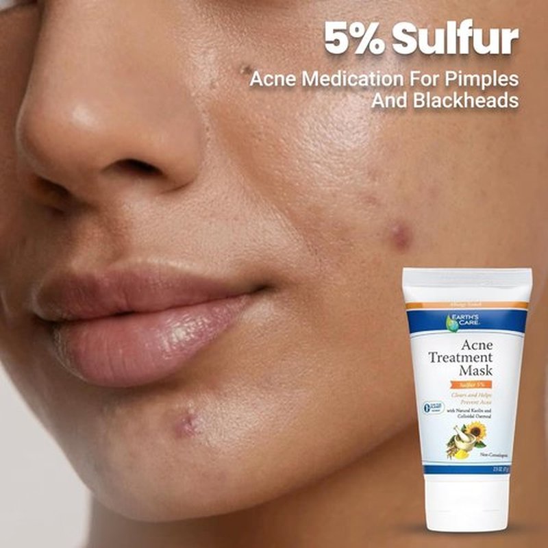 Earth's Care Acne Treatment Mask - 5% Sulfur Formula for Cystic Acne - 2.5 OZ Tube for Face Pimples & Blackheads