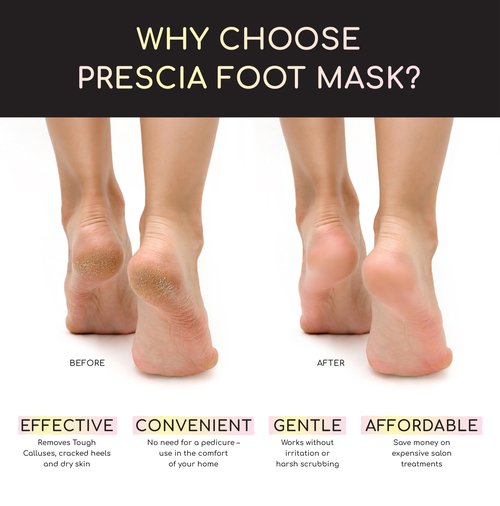 Prescia Foot Peel Mask - For Cracked Heels, Dead Skin & Calluses - Baby Soft Feet, Smooth Skin, Removes & Repairs Rough Heels, Dry Toe Skin - Exfoliating Peeling Natural Treatment - Crescena