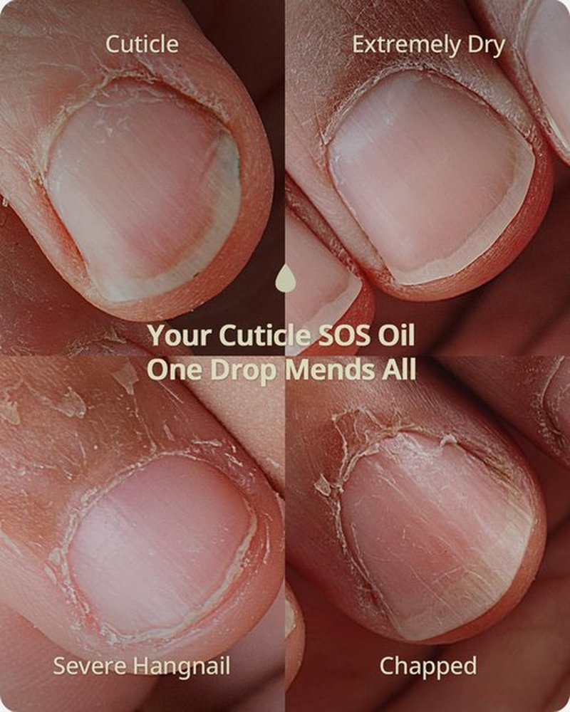 BTARTBOXNAILS Nutri-Forte Cuticle Oil - Deeply Nourishing Formula with Olive Oil & Vitamin E, 15ml