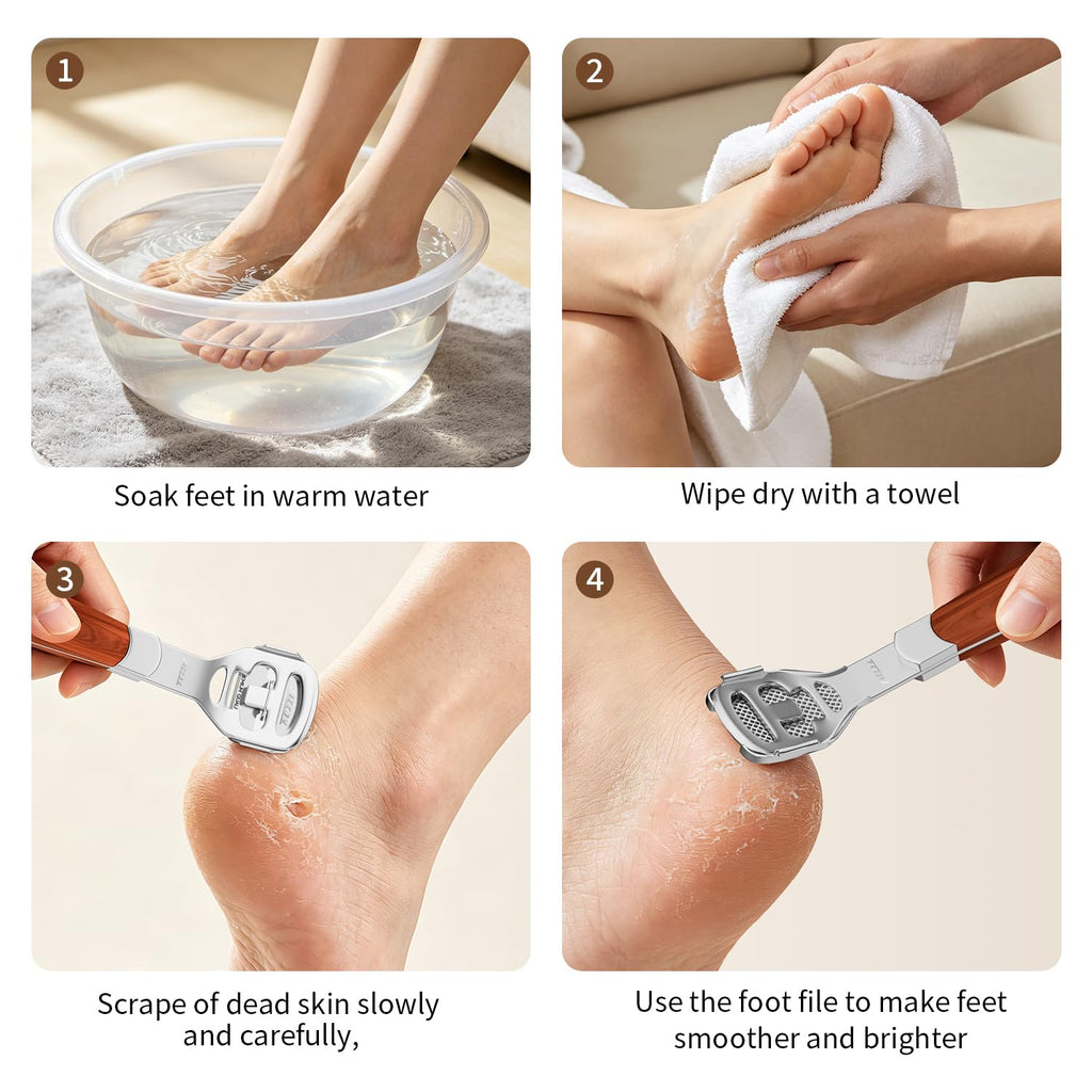 Foot Care Pedicure Callus Shaver Hard Skin Remover Wood Handle 10 Blades