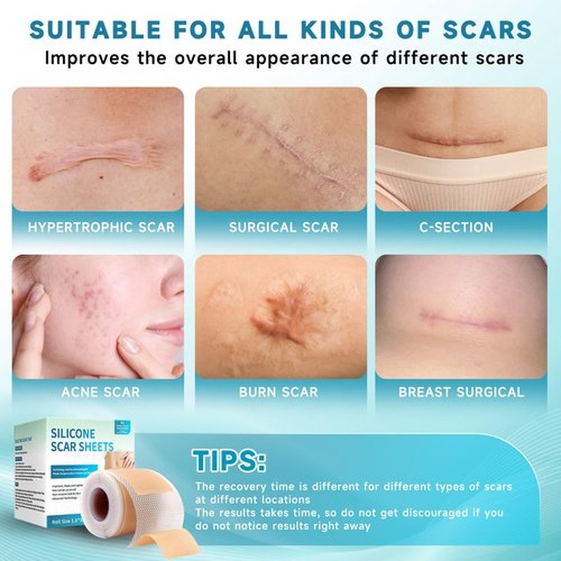 Silicone Scar Sheets, Silicone Scar Tape(1.6”x 120” Roll-3M), Silicone Scar Strips, Professional Scar Removal Sheets for Surgical Scars, Keloid, C-Section, Burn et