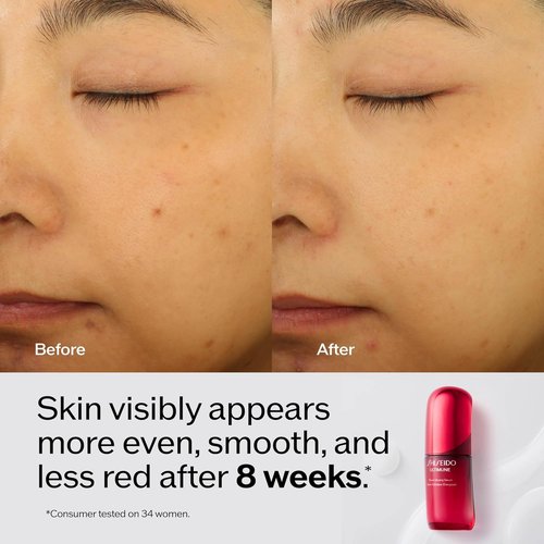 Shiseido Ultimune Power Infusing Serum - Lightweight Anti-Aging Face Serum - Boosts Radiance for All Skin Types