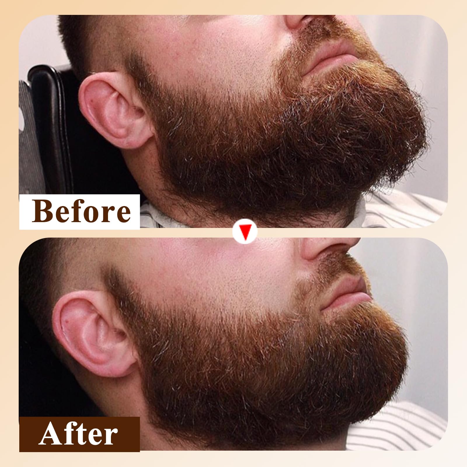 Varolan Beard Oil Capsules for Men,Natural Cedarwood Mens Beard Oil,Naturally Derived Conditioner with Argan Oil,Grapeseed Oil,Jojoba Oil and Vitamin E for Softening and Moisturizing Beard