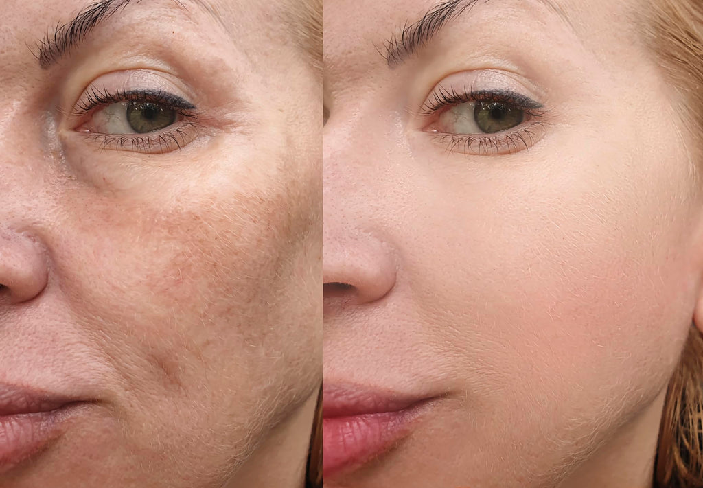Vitality Precision Skin Micro-Exfoliating Scrub