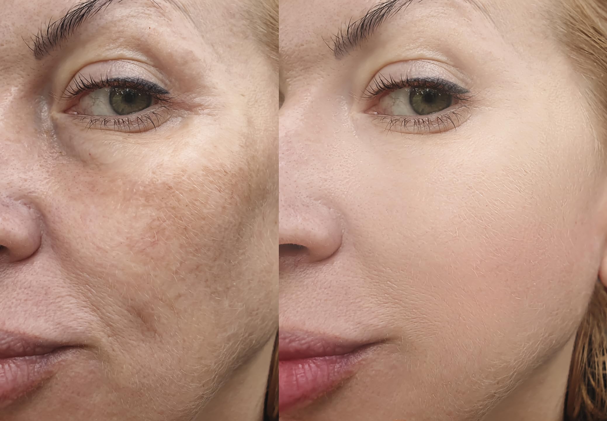Vitality Precision Skin Micro-Exfoliating Scrub