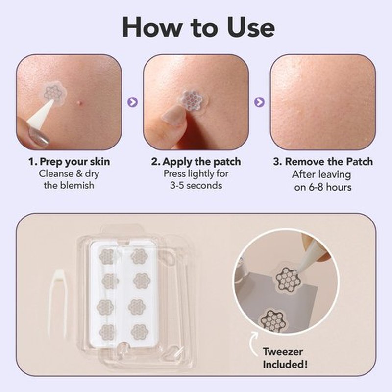 Magnesium Blemish Microdarts | Pimple Patch | Fast-Acting | Quick Calming | 99.9% Pure Magnesium | Madecassic Acid | Tea Tree | Eucalyptus Leaf | Hydrocolloid Spot Care Patch (Small 10 Patches)