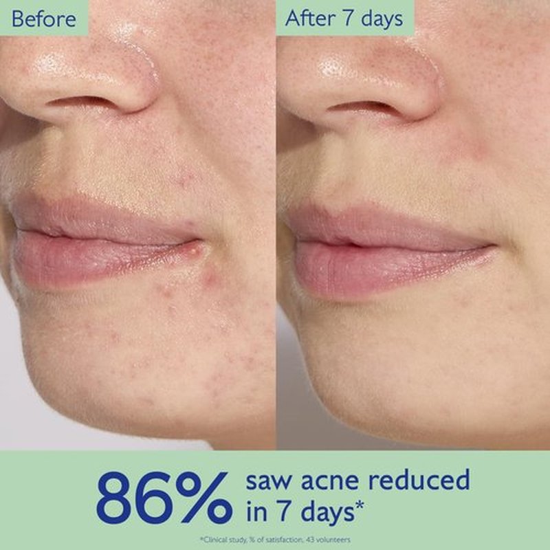Caudalie Vinopure Acne Treatment - Salicylic Acid Serum for Blemish Control | 30 mL