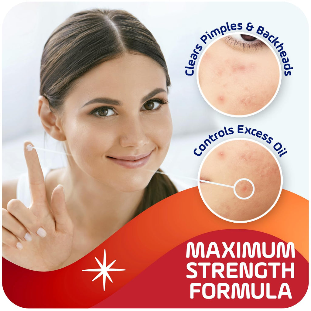 Asepxia 2% Salicylic Acid Acne Spot Treatment Cream | Drying Formula Targets Acne, Clears & Prevents Blemishes, Reduces Redness, Penetrates Pores, Pimple Cream, 1 Oz, 1-Pack