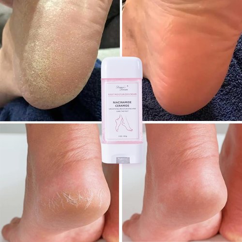DIANA'S DREAM Foot Cream Foot Moisturizer, Dry|Cracked Foot Repair Ultra-Hydrating Foot Cream Moisturizer, Foot Repair Skin Healing Ointment for Cracked Heels and Dry Feet, 3 Oz
