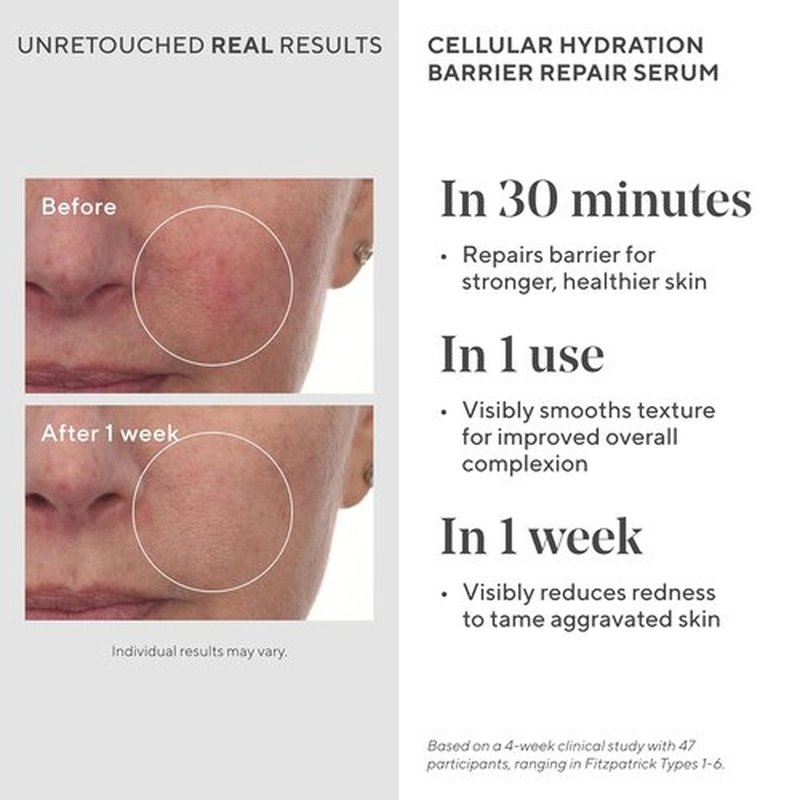Murad Cellular Hydration Serum - Hydrating Formula with Hyaluronic Acid & Peptides for Skin Barrier Repair - 0.5 Fl Oz