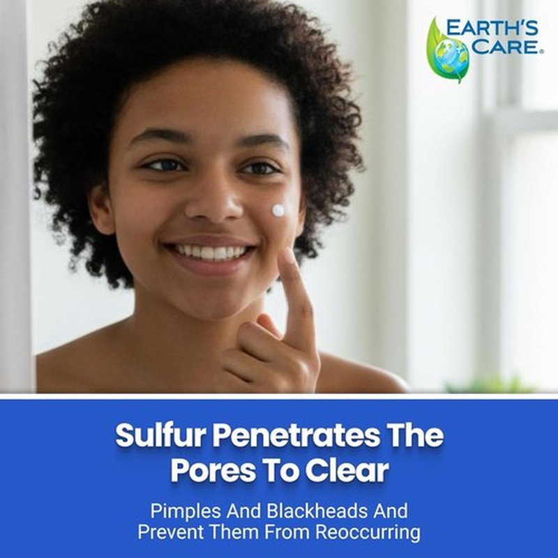 Earth's Care Acne Spot Treatment - 10% Sulfur Cream for Cystic Acne, Pimples & Blackheads | 0.97 OZ Tube