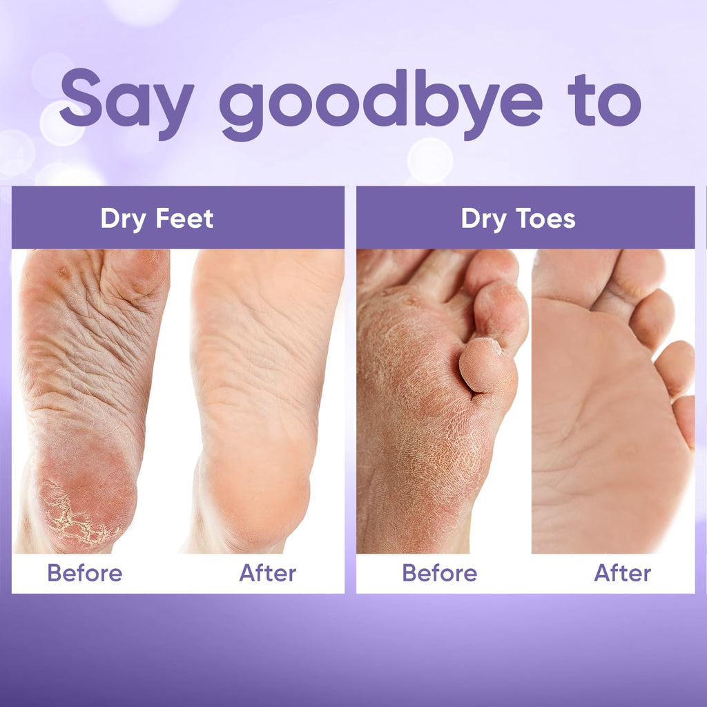 CÉLOR Foot Peeling Mask for Dry Cracked Feet | Foot Mask to Exfoliate Rough, Cracked, Dry Feet, Calluses for Soft Baby Feet Results | Made with Aloe Vera Extract for Women & Men (2 Pairs) | Lavender