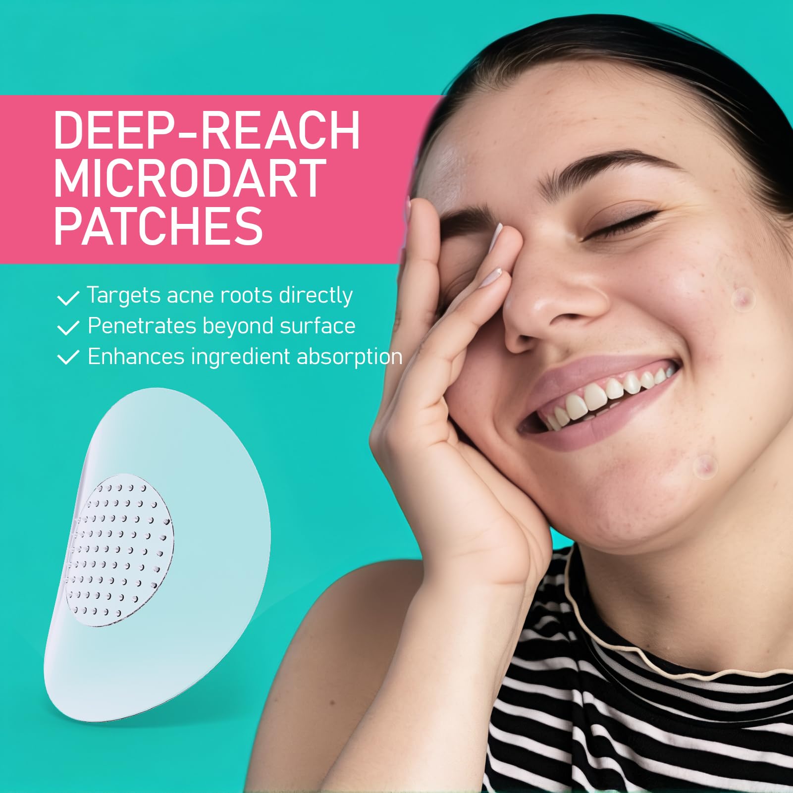 ANGTICS 36 Count Pimple Patches Microdart, Zit Patches with Microdart Technology, Salicylic Acid, Sodium Hyaluronate, Centella Extract, Acne Patch for Blemishes, Zits