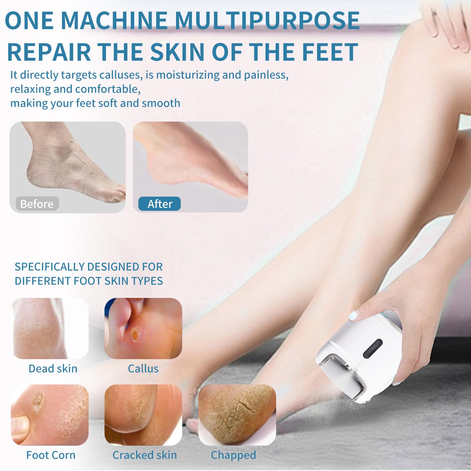 YunManHT Electric Foot Callus Remover, Rechargeable Portable Spray Foot Grinder, Quartz Sand Grinding Head for Foot Trimming and Dead Skin Removal, File Tool Suitable for Dry and Cracked Feet