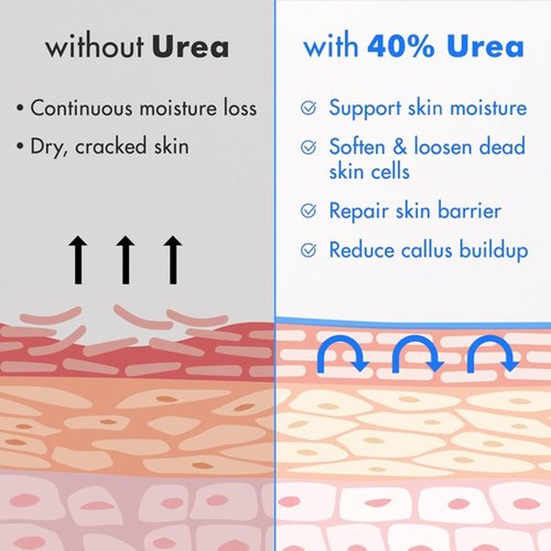 Ebanel Urea Cream 40% & Salicylic Acid 2% - Intensive Foot Cream for Dry, Cracked Skin | 2-Pack
