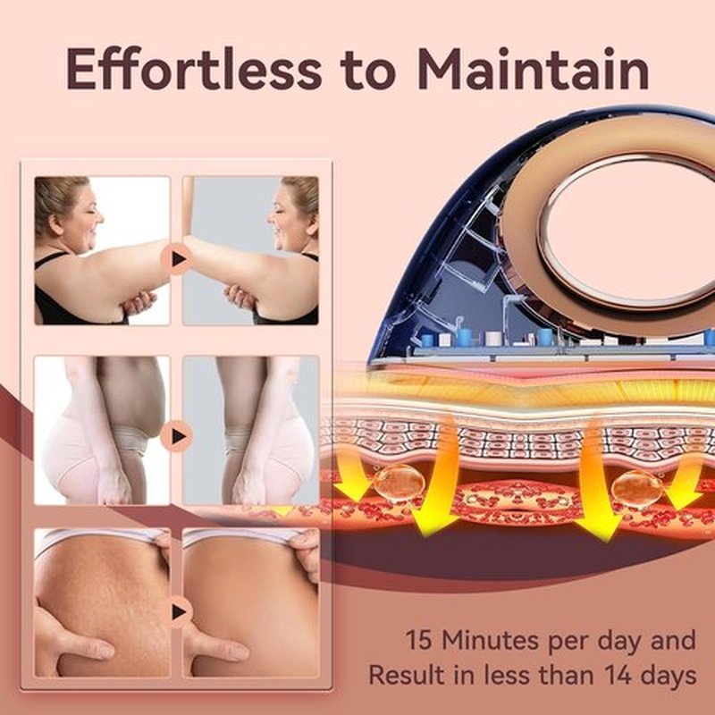 Skiennix Cellulite Body Device - Radio Frequency Massage for Temporary Reduction | White