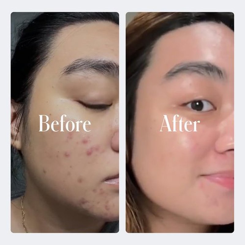 Geologie Retinol Anti-Aging Face Cream | Advanced .3% Retinol Formula for Effective Results | Reduce Fine Lines & Wrinkles | Protect & Repair Skin With Hyaluronic Acid & Niacinamide | For Men & Women