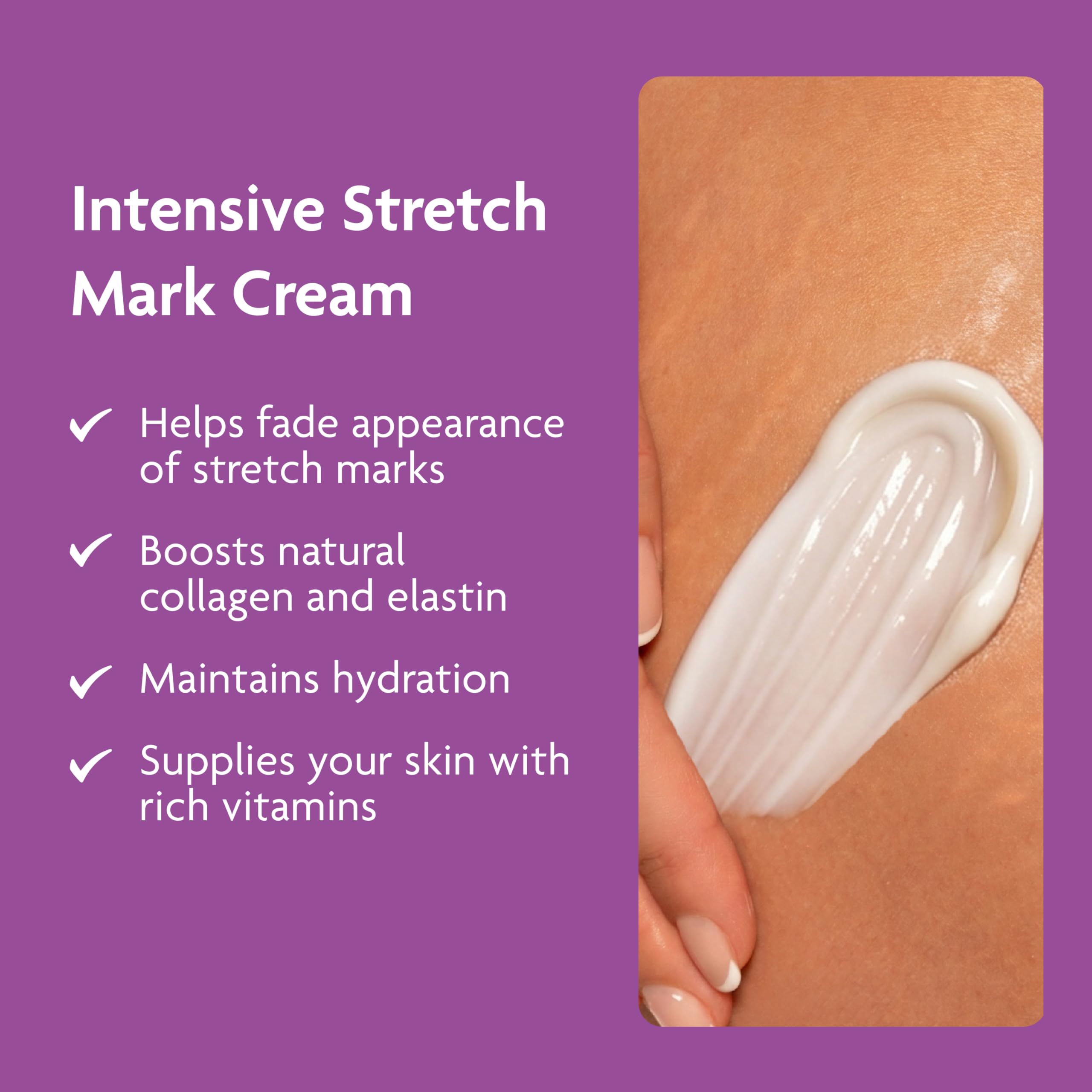 TriLASTIN Stretch Mark Cream – Collagen & Elastin Support Body Cream with Niacinamide, Vitamin C & Vitamin E – Hydrating Stretch Mark Lotion for Belly, Hips & Thighs – Unscented - 5.5 oz