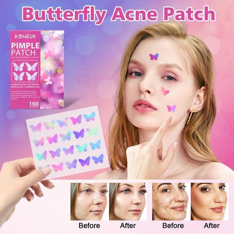 Acne Pimple Patches for Face (160 Counts), Hydrocolloid Acne Patches with Tea Tree Oil and Calendula Extract, Cute Colorful Butterfly Shape Spot Stickers for Skin Care, Zit Patches