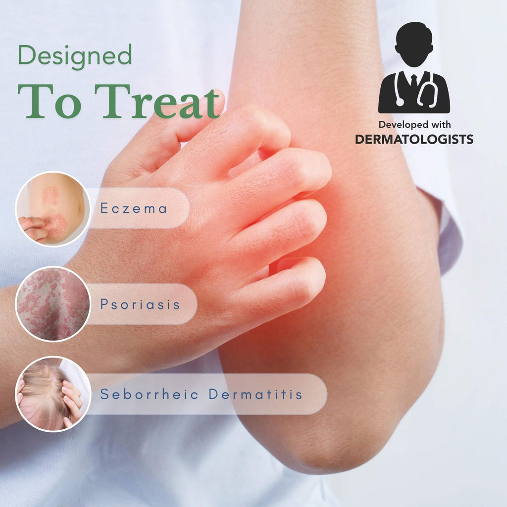Theraplex AIM - Anti-Itch Moisturizing Cream (3 oz) - Non-stinging, Relieves Itching, Rashes, Flare Ups - Helps Repair & Restore the Skin's Natural Protective Barrier