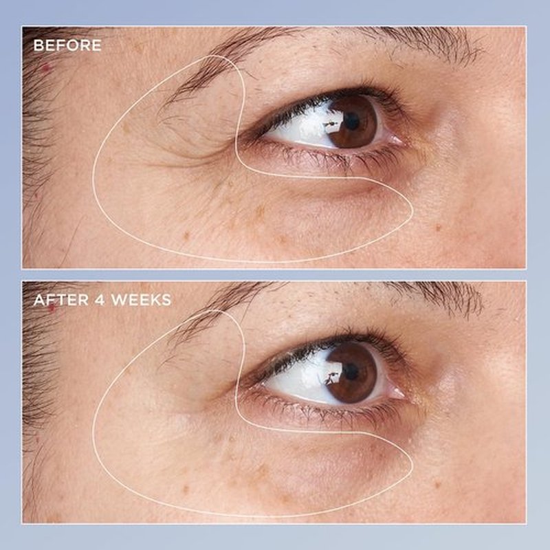 Perricone MD High Potency Eye Serum - Triple Retinol Renewal Formula | 0.5 fl. oz.