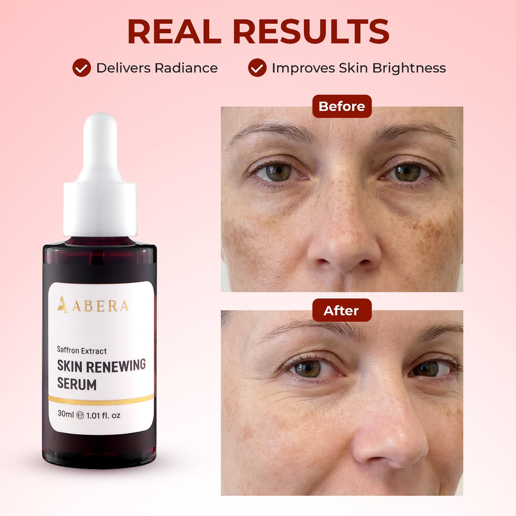 ABERA Renewing Saffron Serum, High-Potency Melasma Treatment for Face & Body, Dark Spot Remover for Age Spot Sun Spot Freckles Brown Spot, Anti-Aging Moisturizer with Hyaluronic Acid & C, 1.01 Fl Oz
