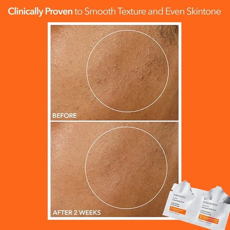 Dr. Dennis Gross Alpha Beta Daily Peel - Smooth Uneven Tone & Texture | Reduces Fine Lines (5 Treatments)